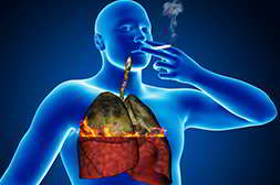 easysmoke универсален, очищает органы от ядов и токсинов