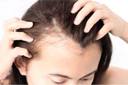 Princess Hair предотвращает выпадение.