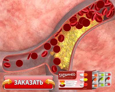 Капсулы Кардинео купить по доступной цене.