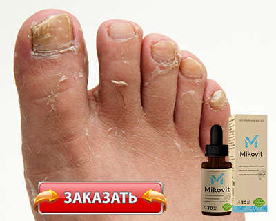 Мазь Миковит купить по доступной цене.