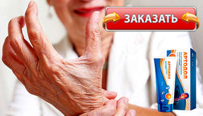 Артодол купить в аптеке.