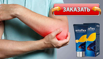 Artroflex купить в аптеке.