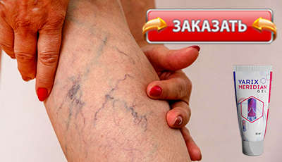 Varix Meridian купить в аптеке.