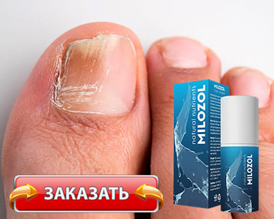 Препарат Milozol купить по доступной цене.